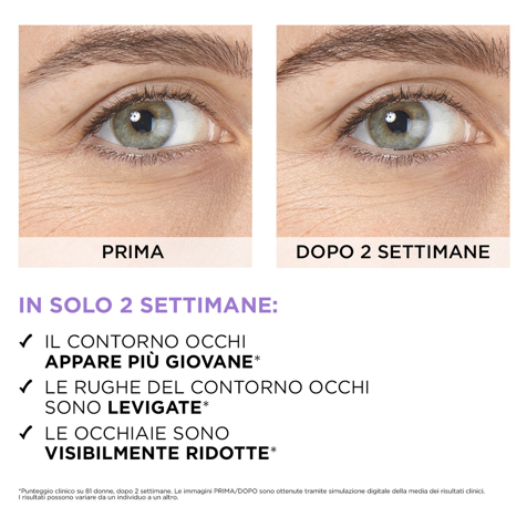 L'Oréal Revitalift Filler Siero Contorno Occhi