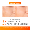 L'Oréal Revitalift Clinical 12% Pura Vitamina C + E + Acido Salicilico Siero Discromie Pori e Rughe