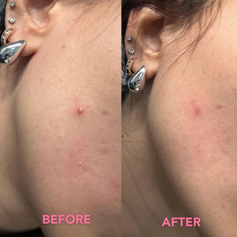 Teaology Tea Glow Blemish Patches