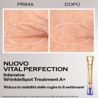 Shiseido Vital Perfection Intensive WrinkleSpot Treatment A+