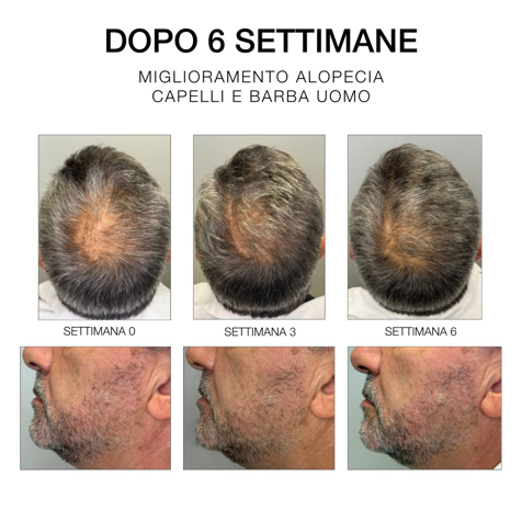 Diego Dalla Palma Milano Estremirimedi - Siero 6 - Trattamento Fortificante Scalpo & Capelli