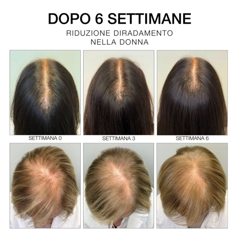 Diego Dalla Palma Milano Estremirimedi - Siero 6 - Trattamento Fortificante Scalpo & Capelli